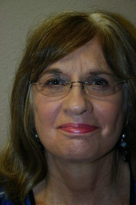 Face Lift Before & After