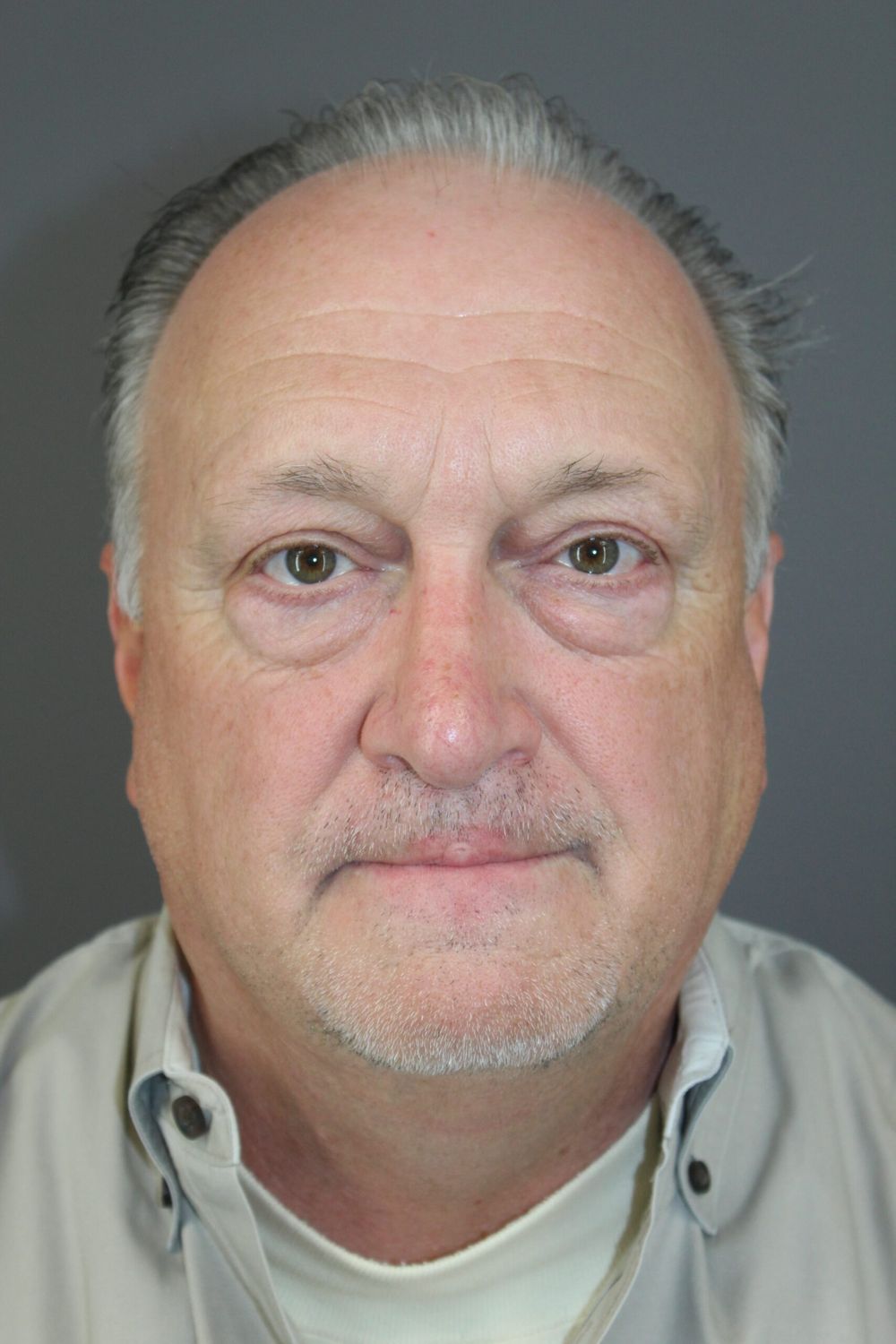 Eyelid Surgery Before & After