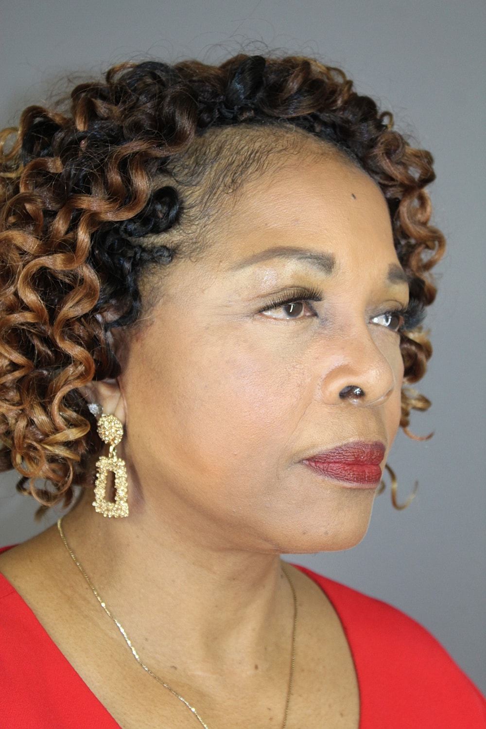 Eyelid Surgery Before & After