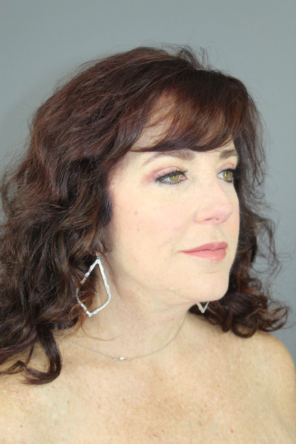 Botox Before & After